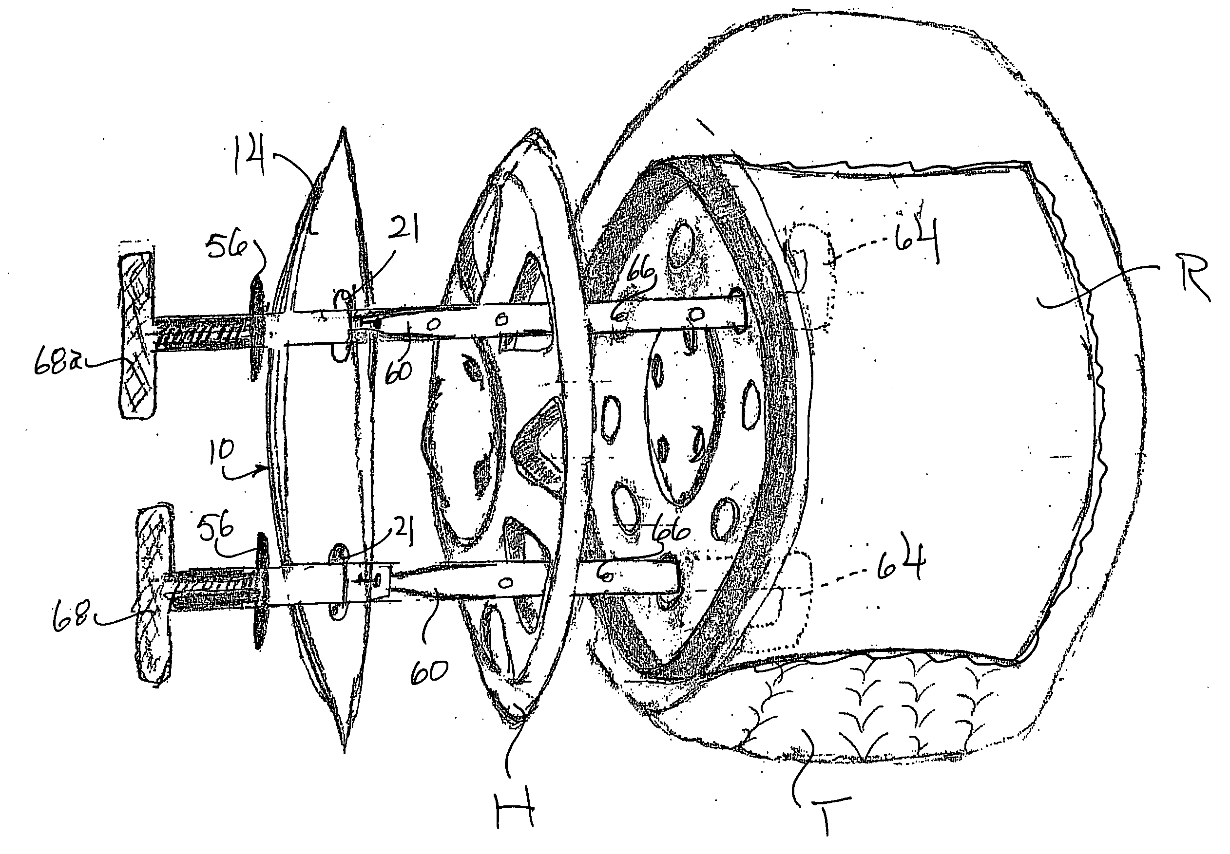 Shield assembly for dressing tires