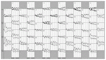 Near-infrared brain imaging spectrum classifying method based on cognition task testing