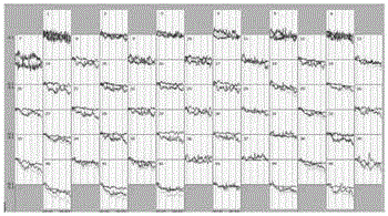 Near-infrared brain imaging spectrum classifying method based on cognition task testing