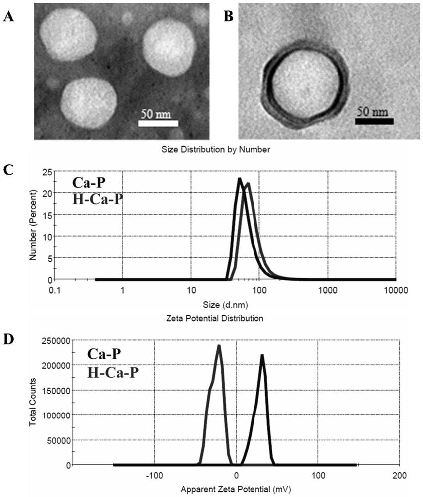 Calcium phosphate-lipid nano-drug co-delivery system composed of low molecular weight heparin and natural drug prodrug