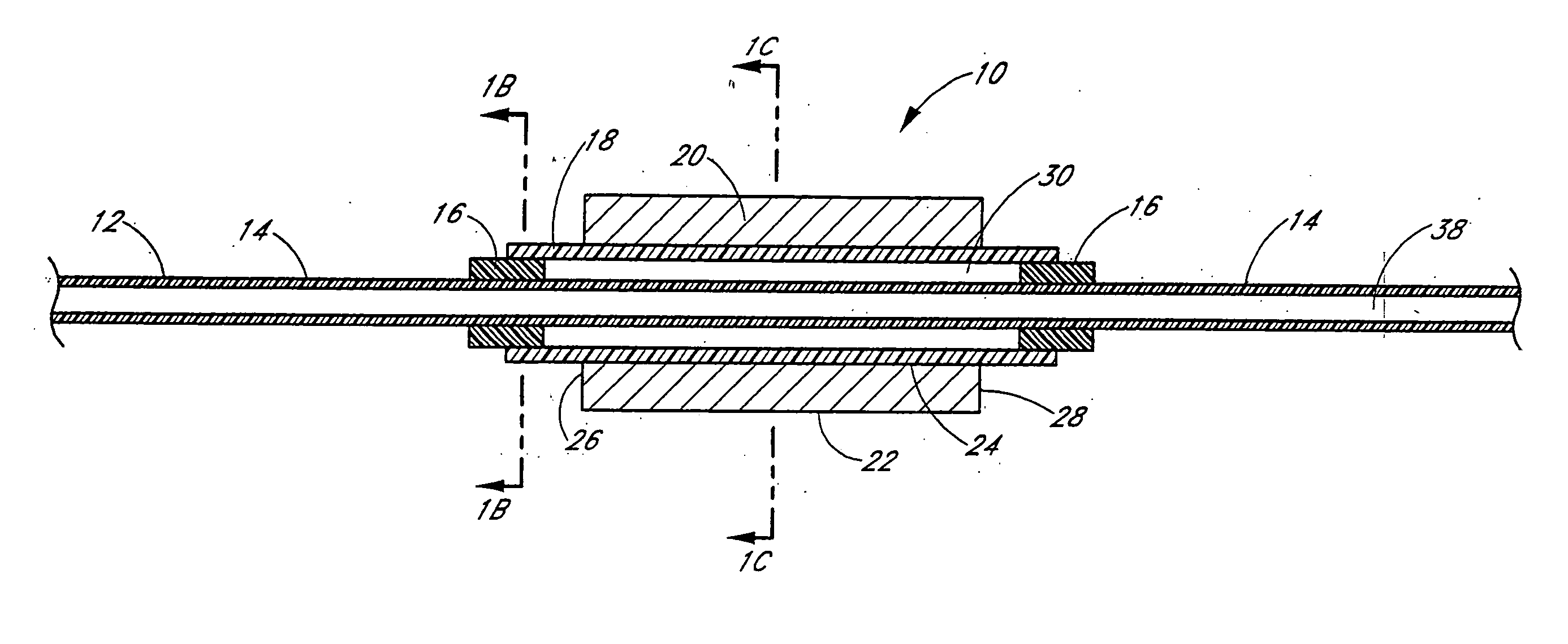 Ultrasound catheter