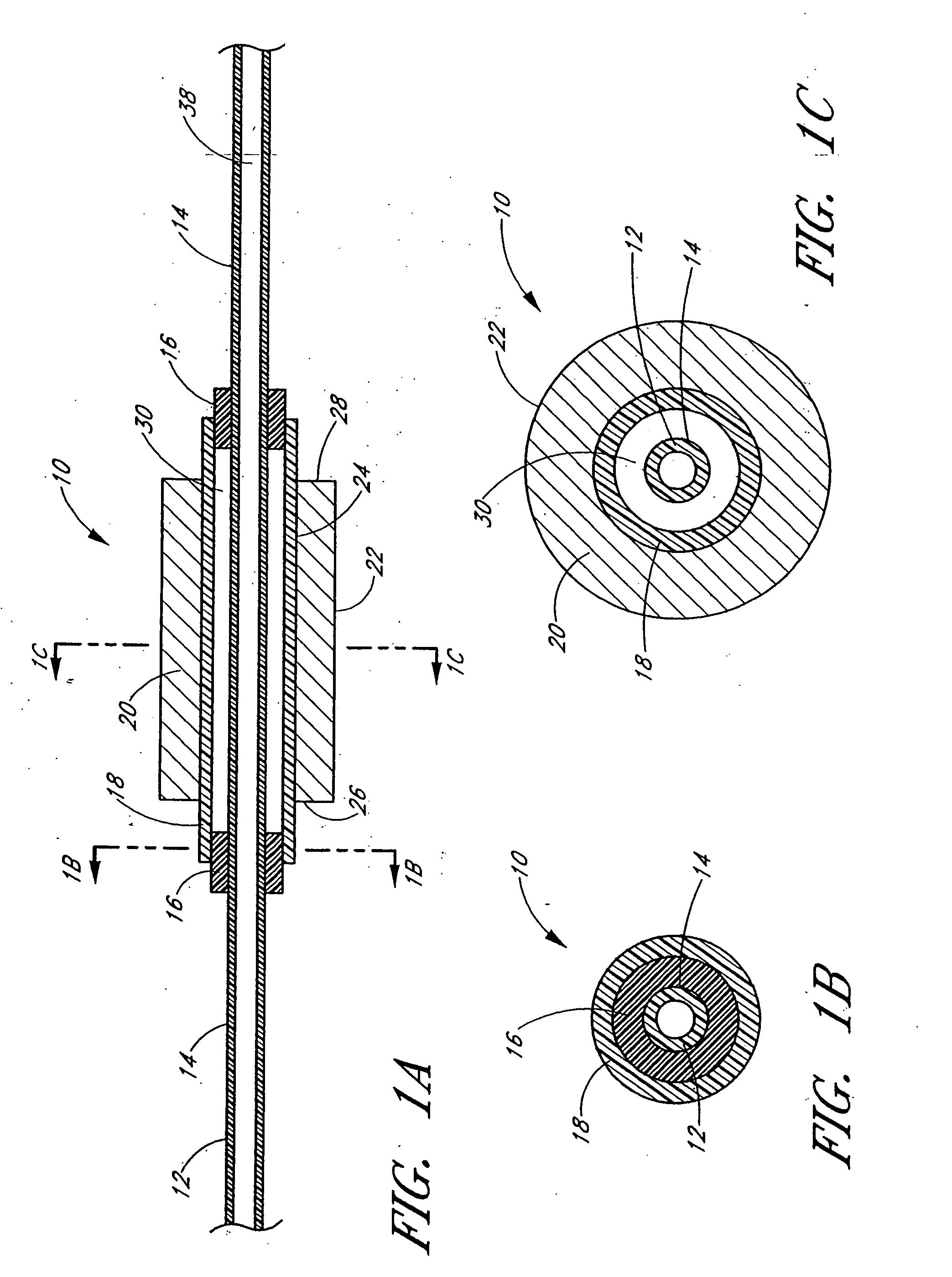 Ultrasound catheter