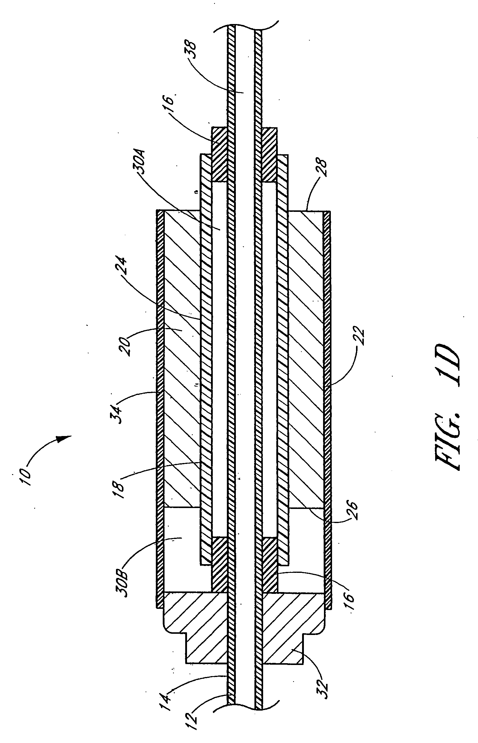 Ultrasound catheter