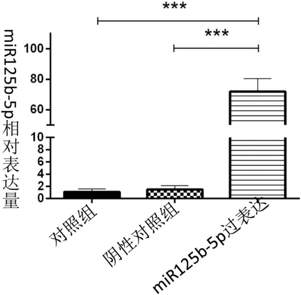 Applications of miR125b-5p in preparing drugs used for preventing endothelial cell damages