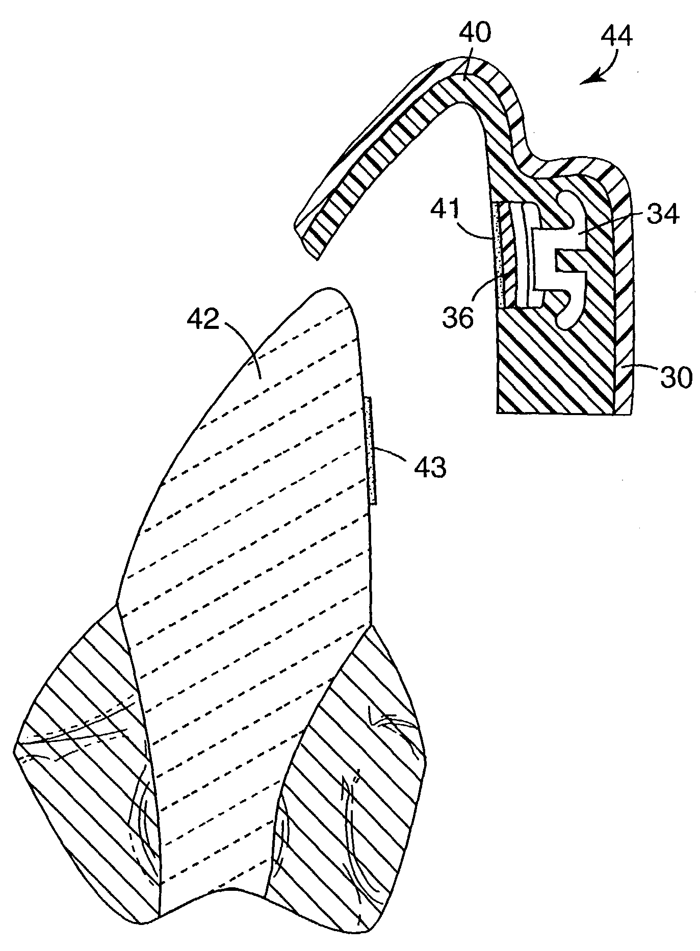 Orthodontic appliances having a contoured bonding surface