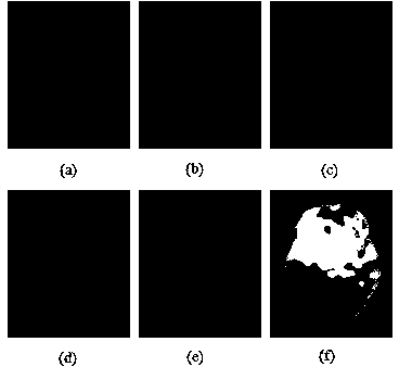 Anisotropic optical flow field and deskew field-based brain MR (magnetic resonance) image registration method