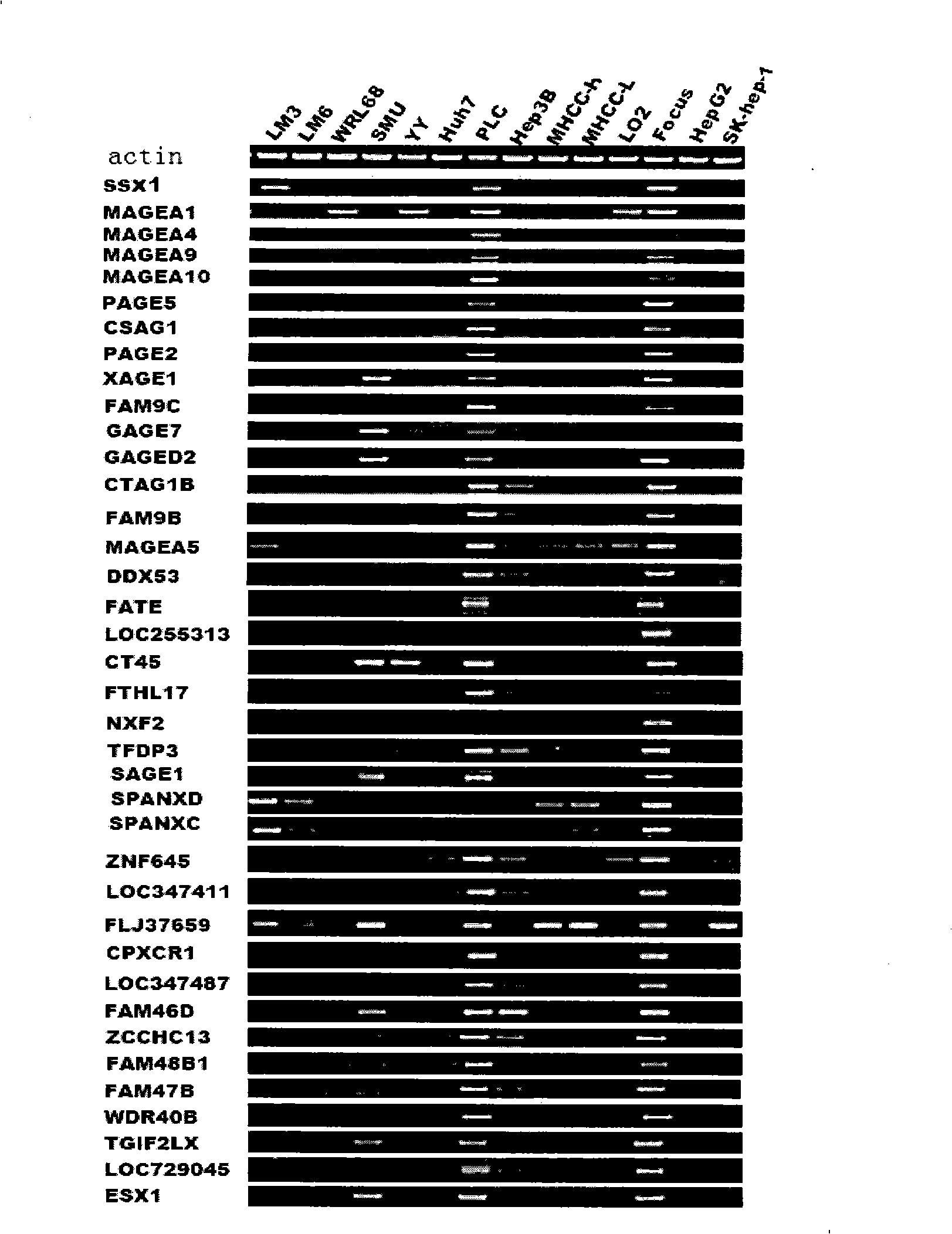 Uses of LOC255313 gene