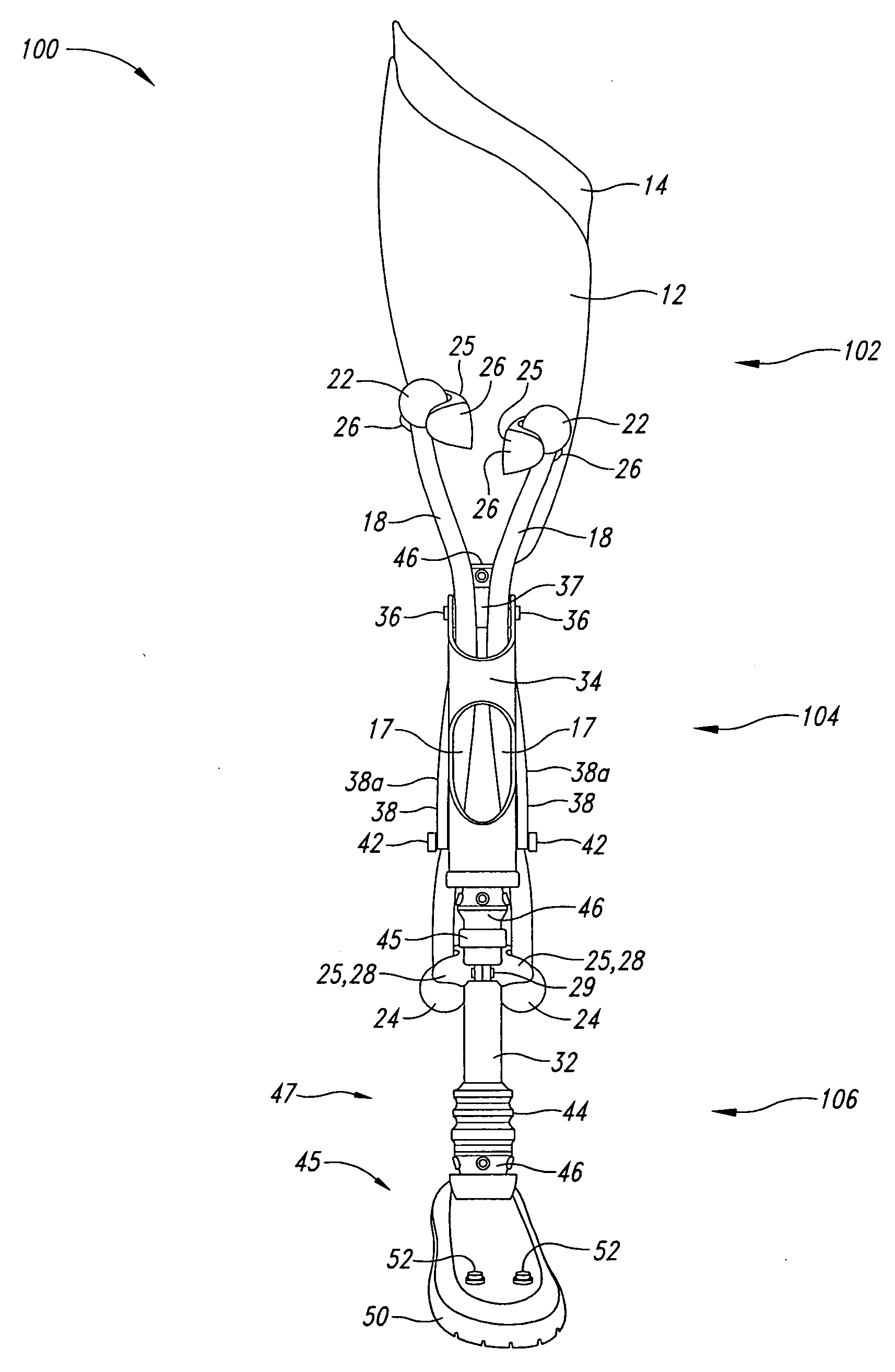 Leg prosthesis system and method