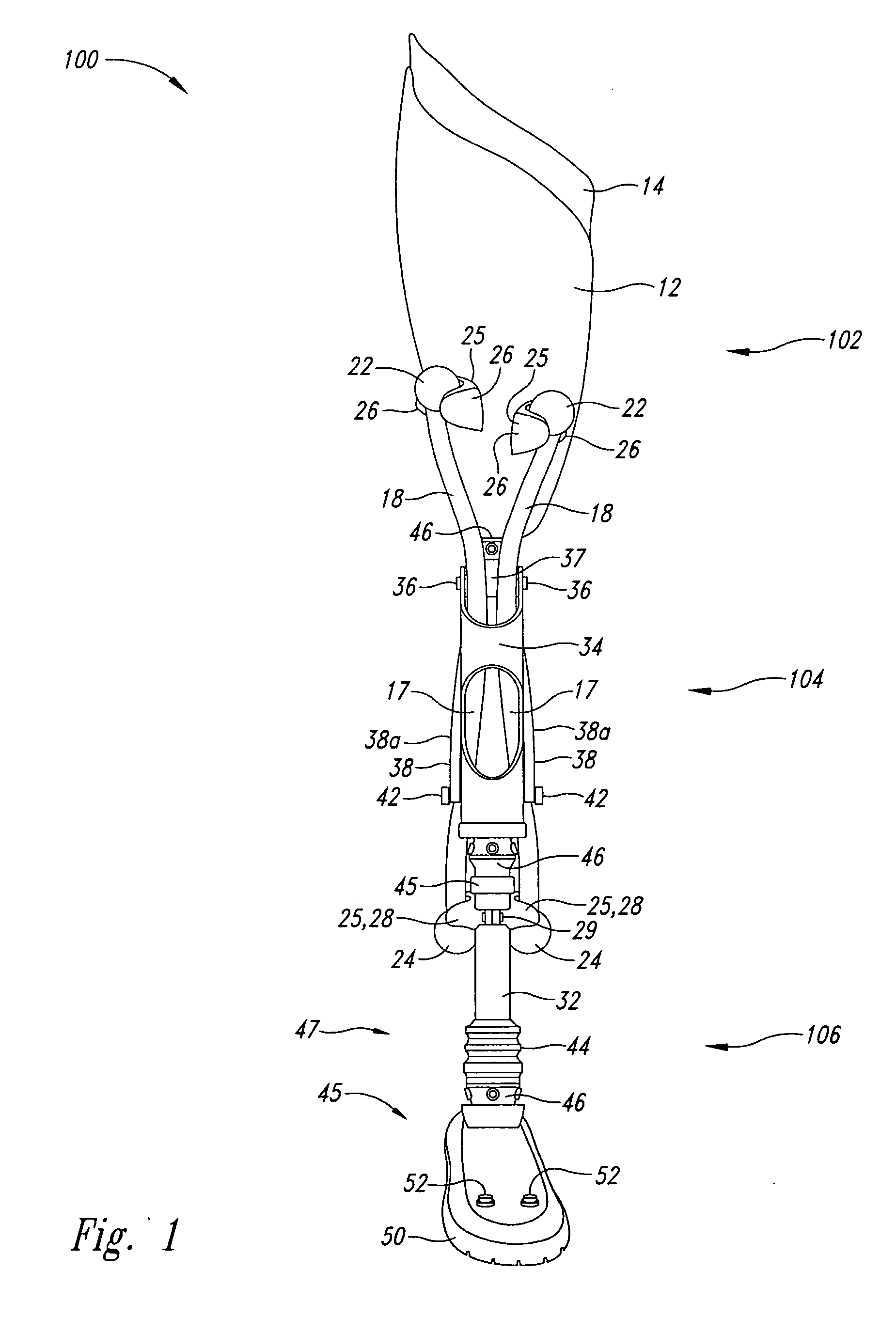 Leg prosthesis system and method