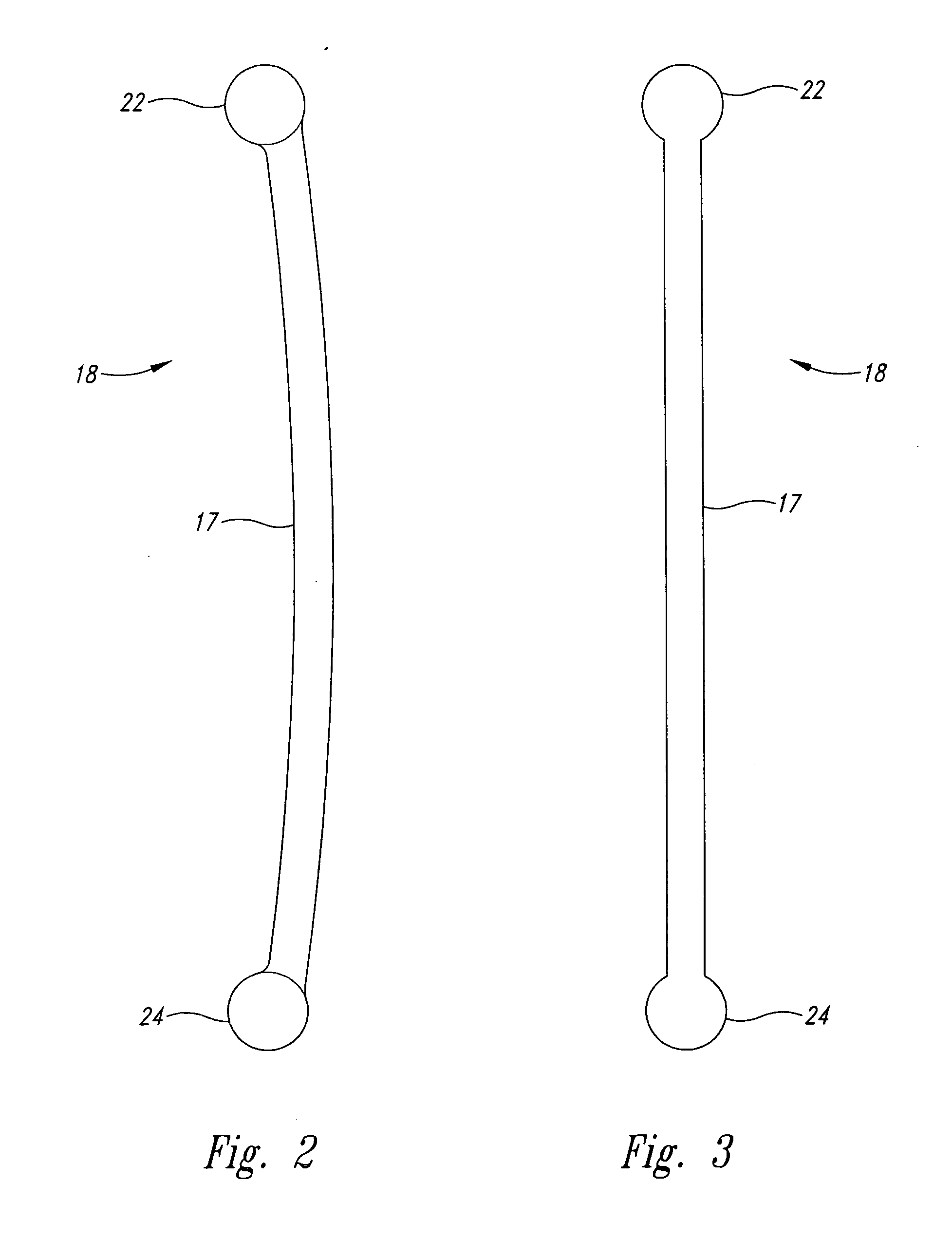 Leg prosthesis system and method