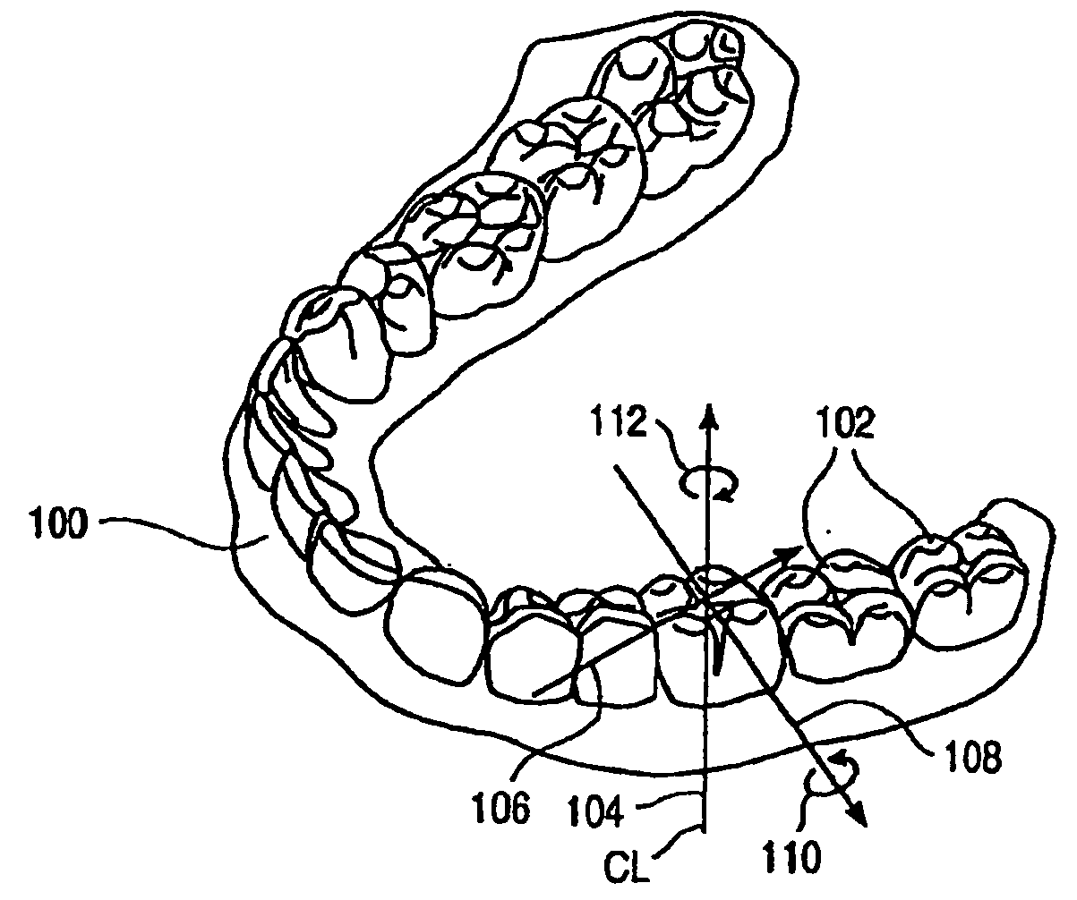 Method and system for incrementally moving teeth