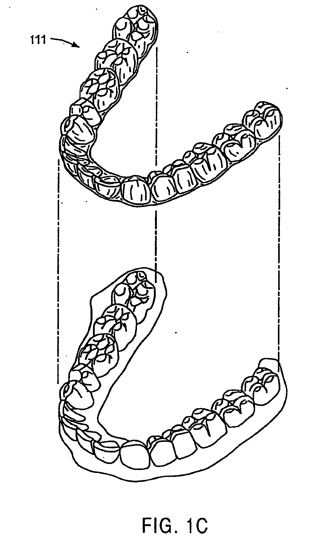 Method and system for incrementally moving teeth