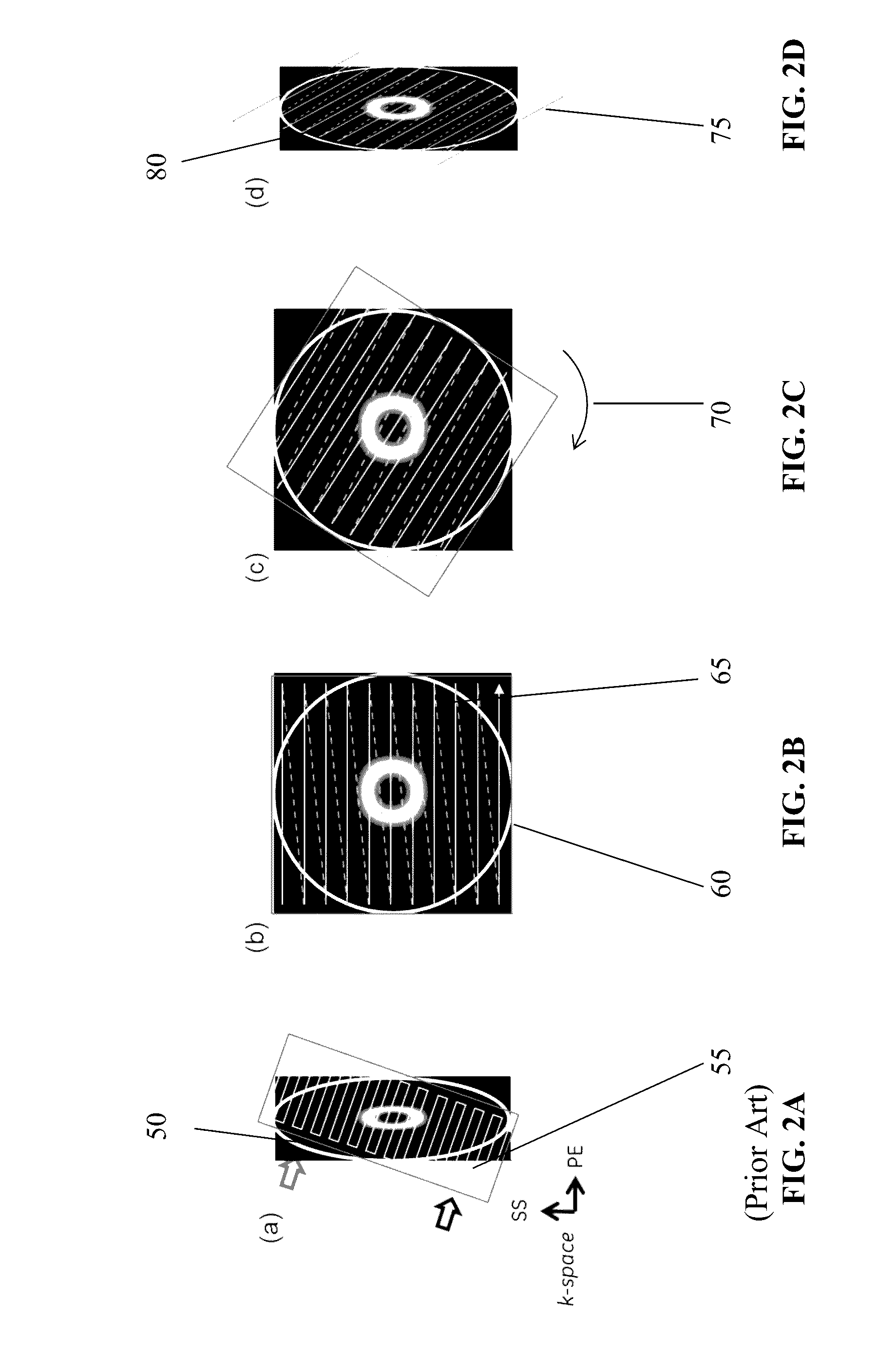 Image Domain Segmented Echo Planar Magnetic Resonance Imaging Using a 2D Excitation Radiofrequency Pulse