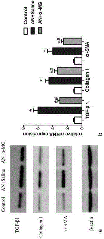 New application of mangosteen to aspect of preparing medicines for treating focal segmental glomerulosclerosis