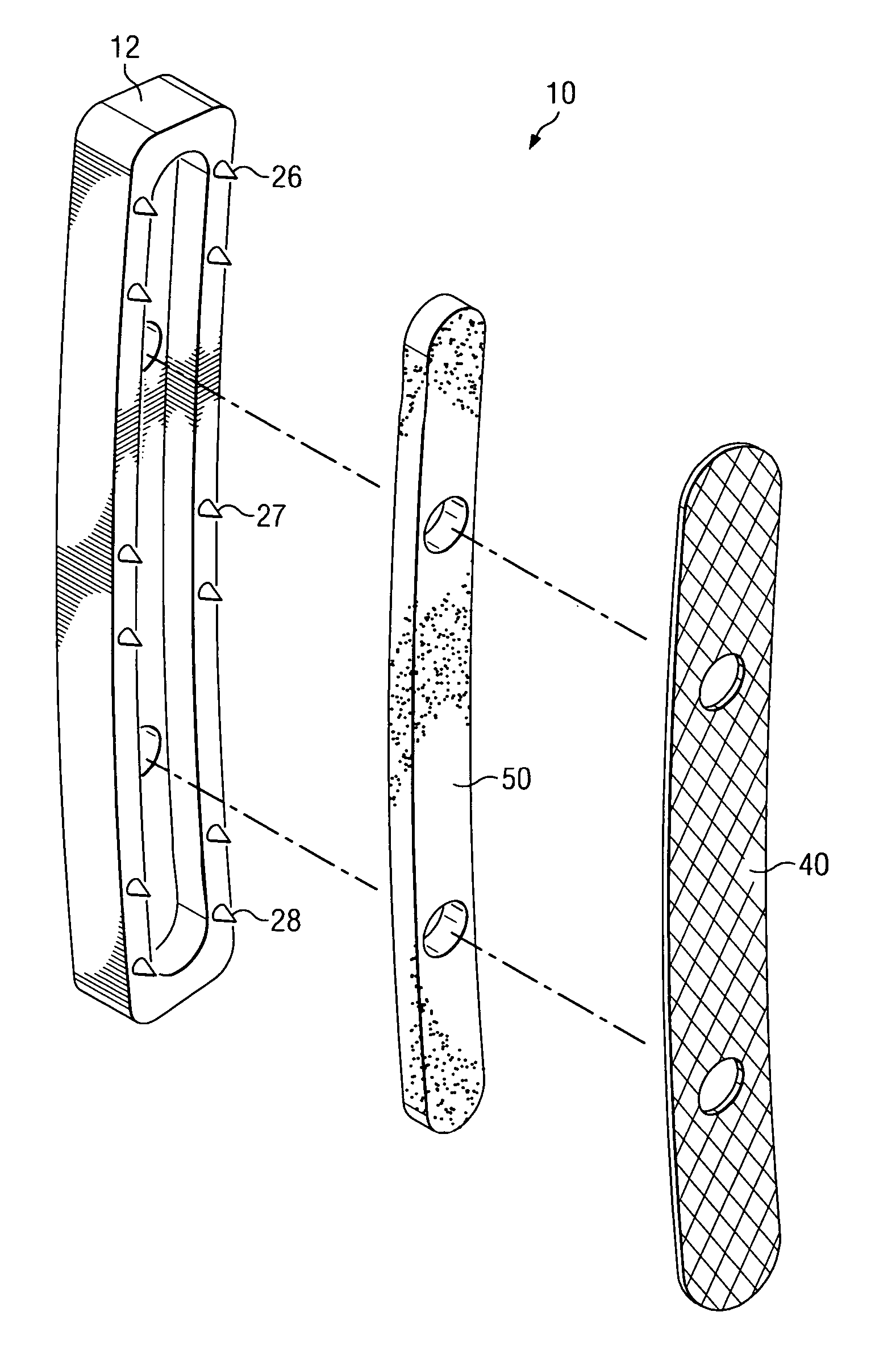 Fixation plate and method of use