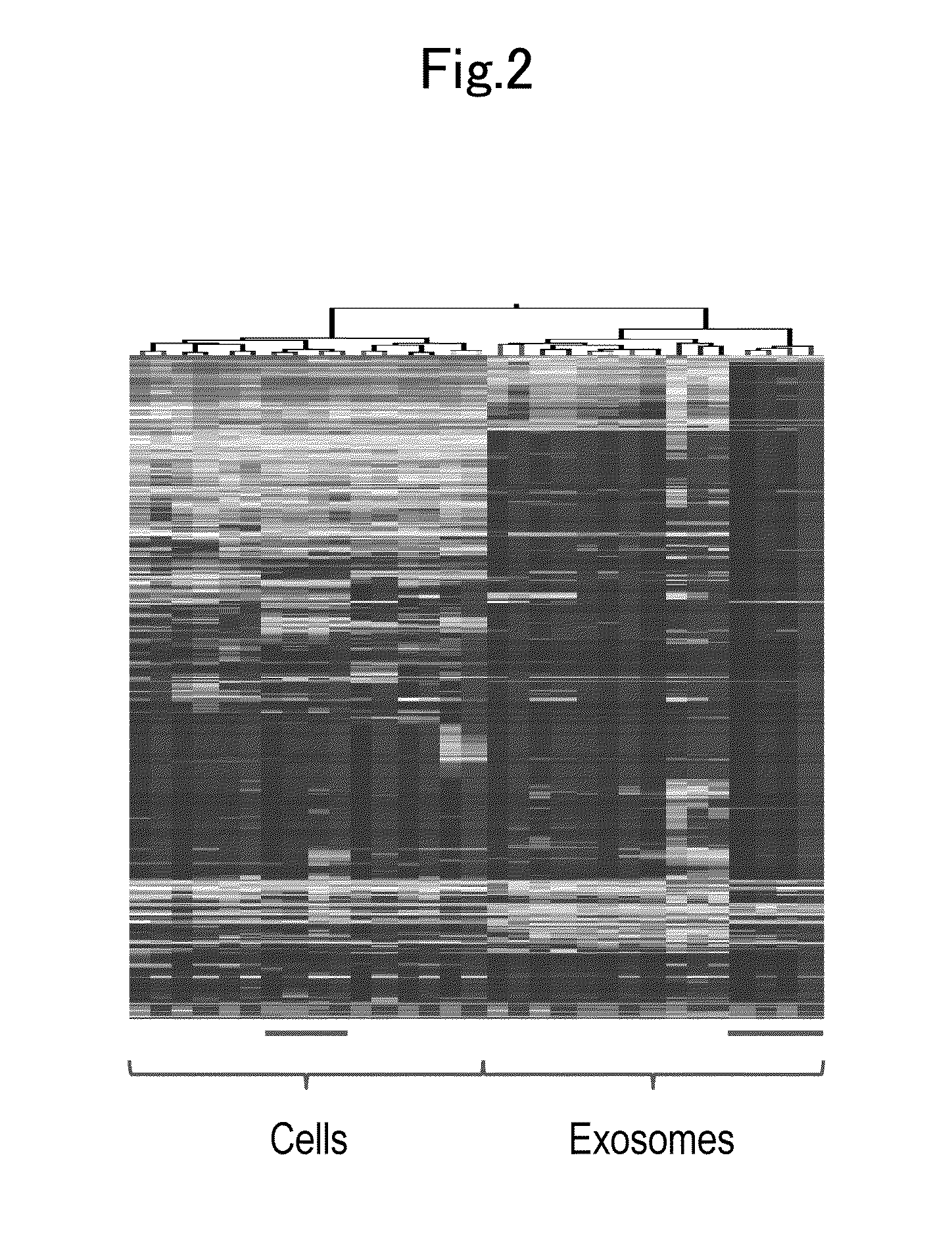 Method for detecting pancreatic cancer and detection kit