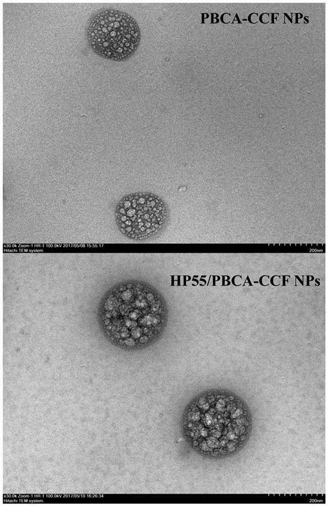 An oral drug delivery system using composite nanomaterials as a carrier