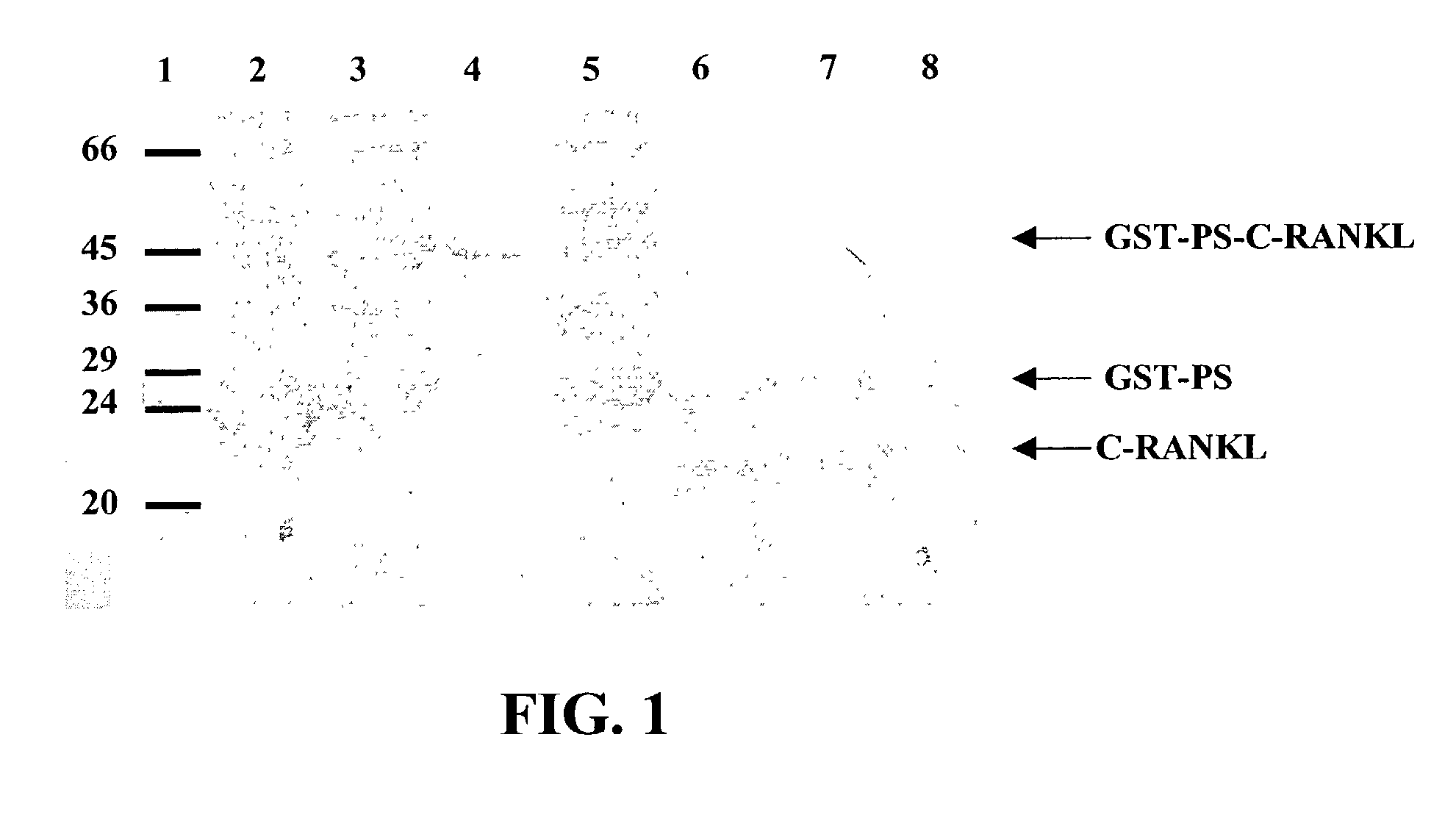 Antigen arrays for treatment of bone disease