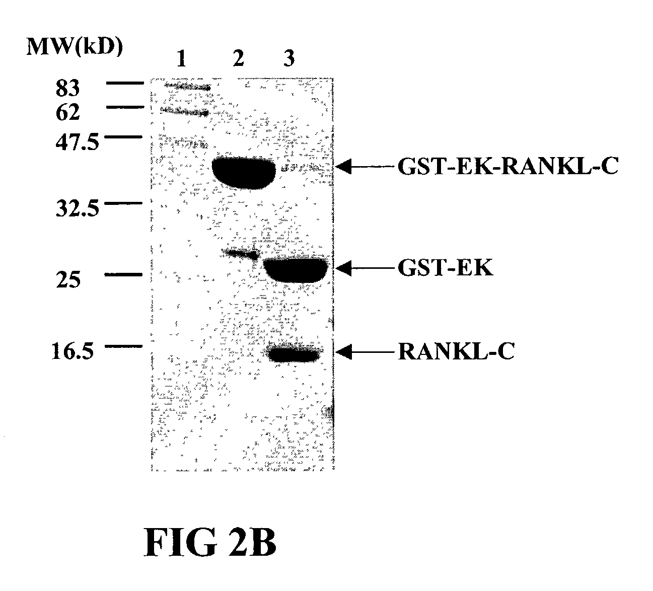 Antigen arrays for treatment of bone disease