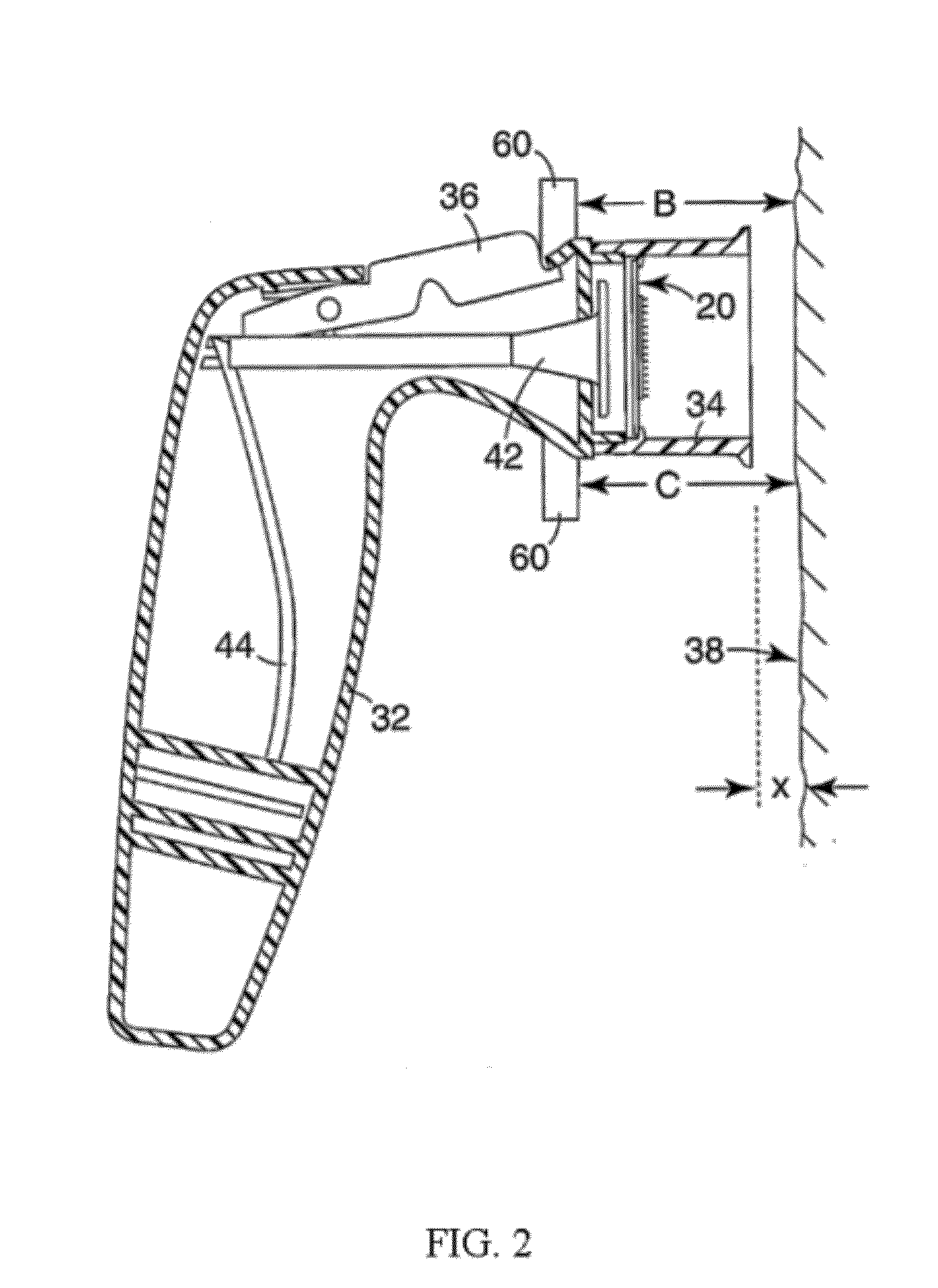 Delivery of bisphosphonates by microinjection systems