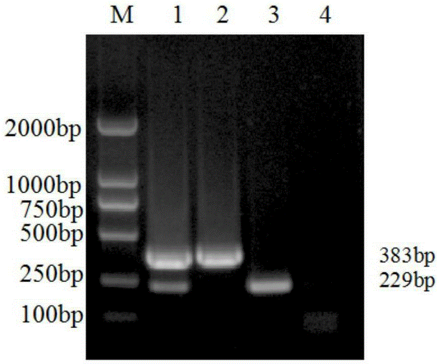 Porcine Deltacoronavirus and swine transmissible gastroenteritis virus multiplex RT-PCR detection primer and detection method