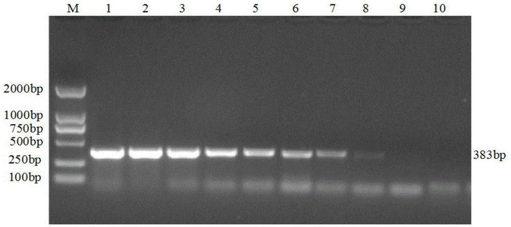 Porcine Deltacoronavirus and swine transmissible gastroenteritis virus multiplex RT-PCR detection primer and detection method