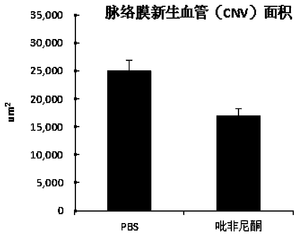 Novel application of pirfenidone