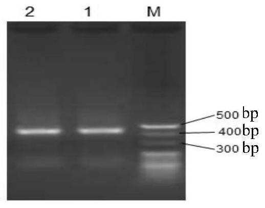 Preparation and application of antimicrobial peptide fusion cytokine campils co-expression biological preparation