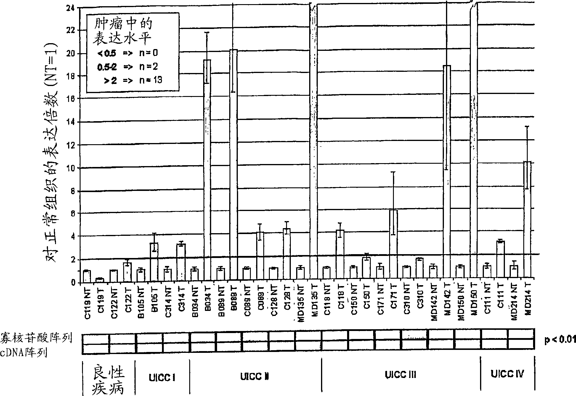 Differentially expressed tumour-specific polypeptides for use in the diagnosis and treatment of cancer