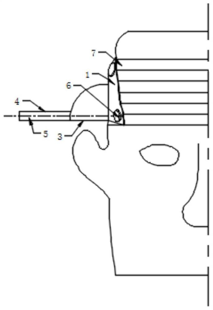 3D operation guide plate for cerebral hemorrhage operation