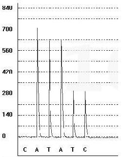 A pyrophosphate detection kit for common pathogens and drug-resistant genomes and its detection method and application