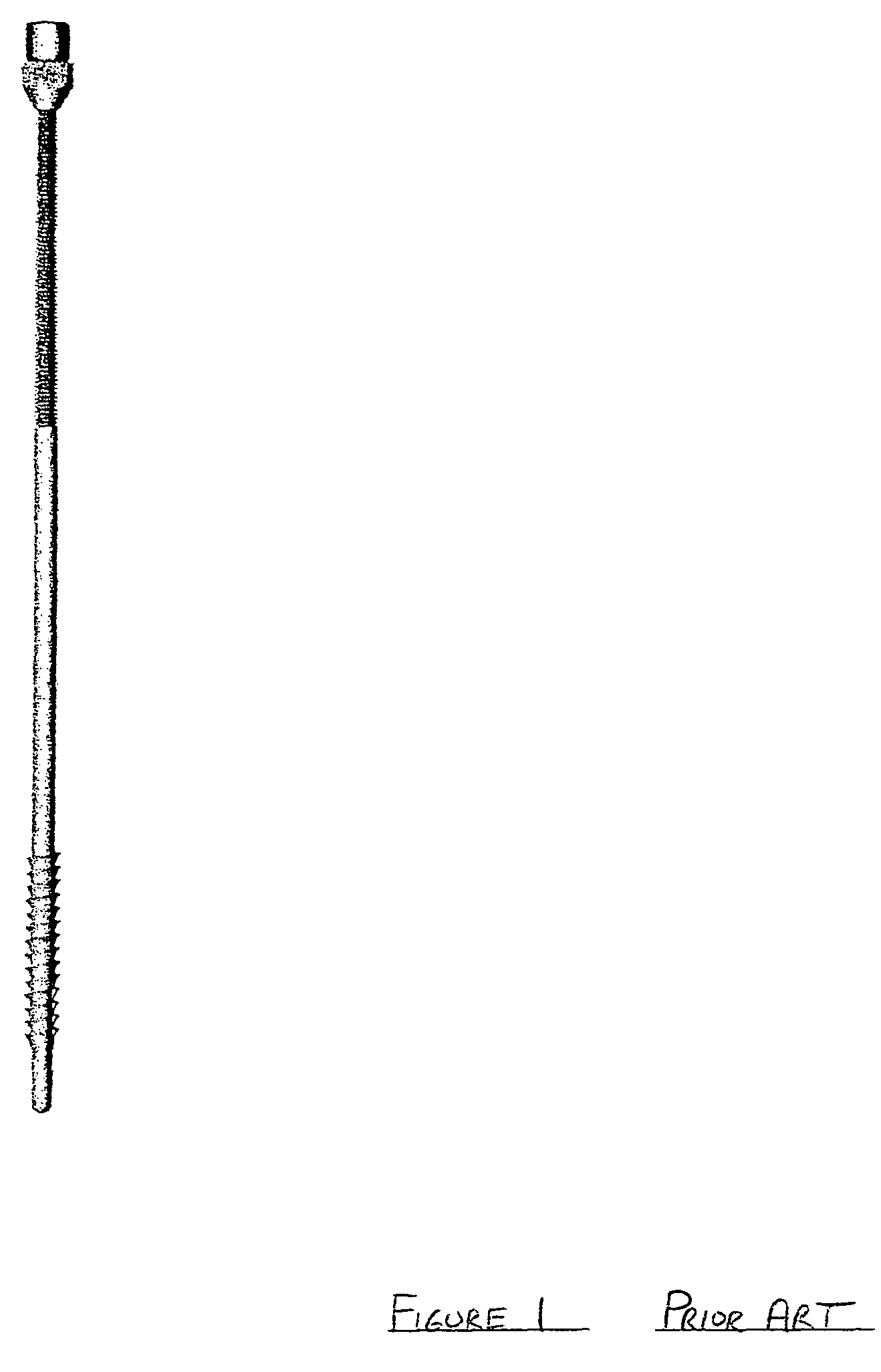 Clavicle repair device and orthopedic intramedullary fixation system