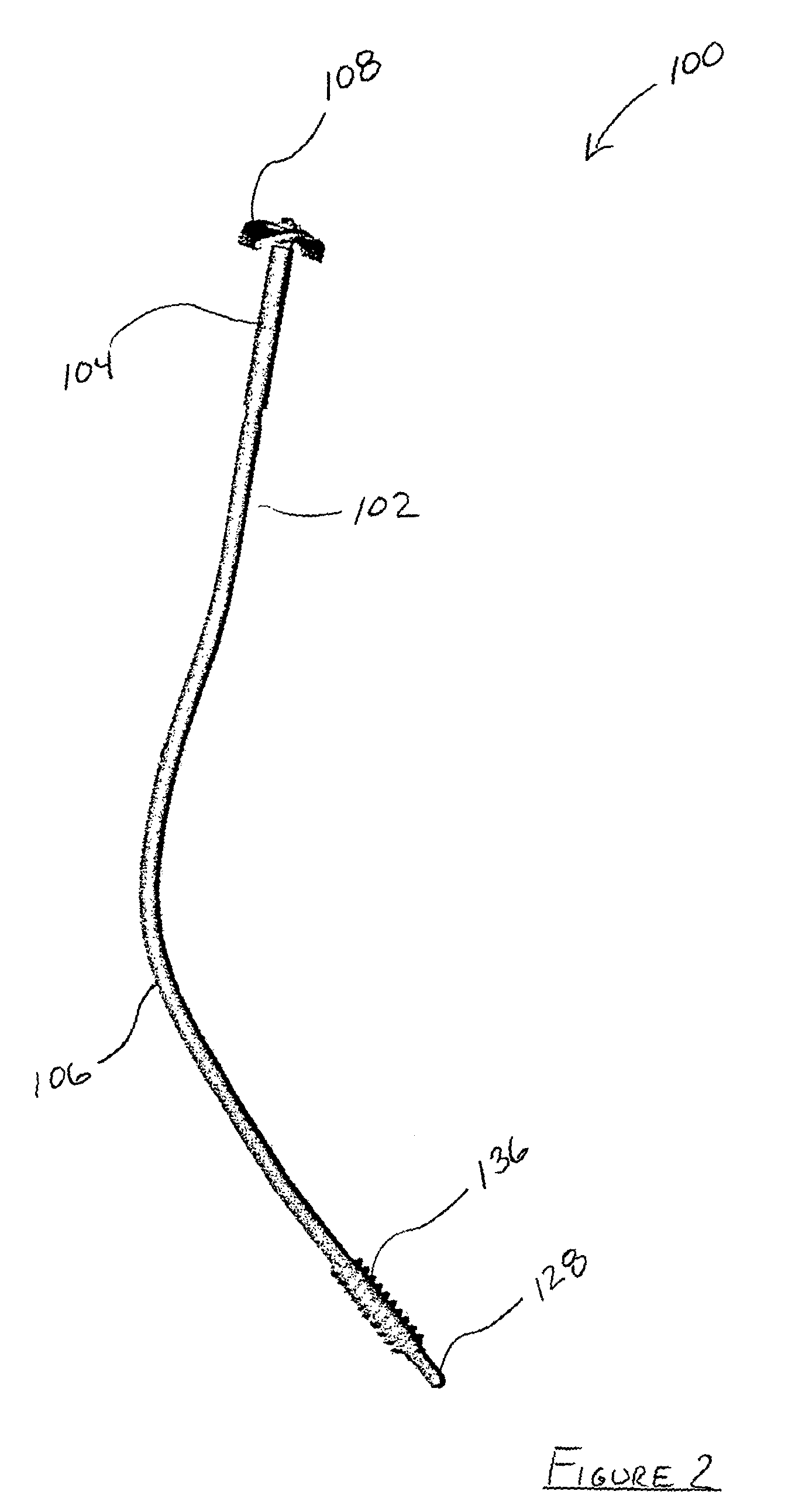 Clavicle repair device and orthopedic intramedullary fixation system