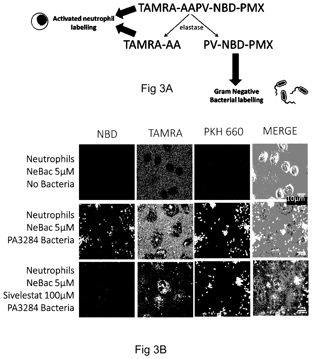 Molecular probes for detecting gram-negative bacteria in vitro and in vivo