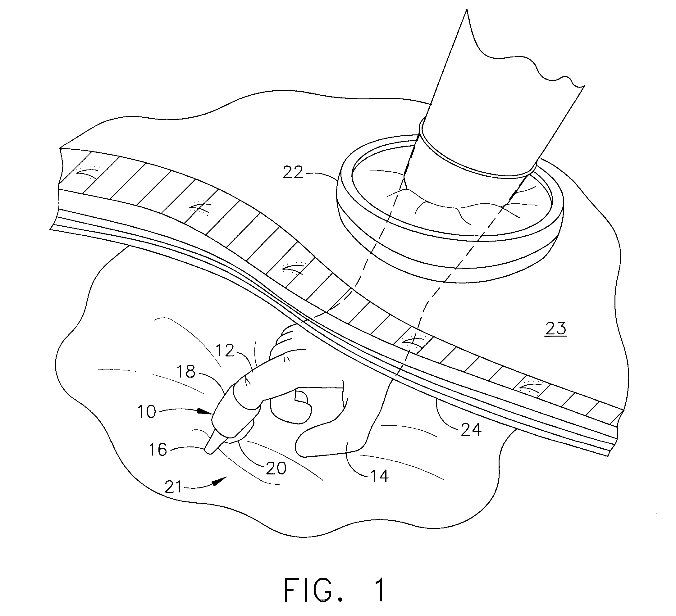 Fingertip Surgical Instrument