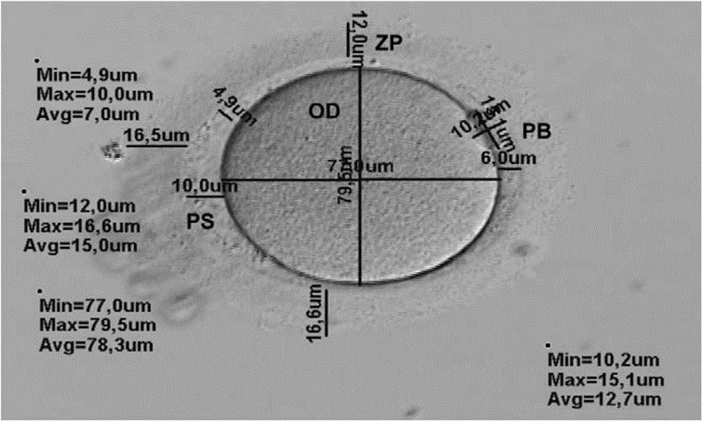 Computer assisted embryo selection method