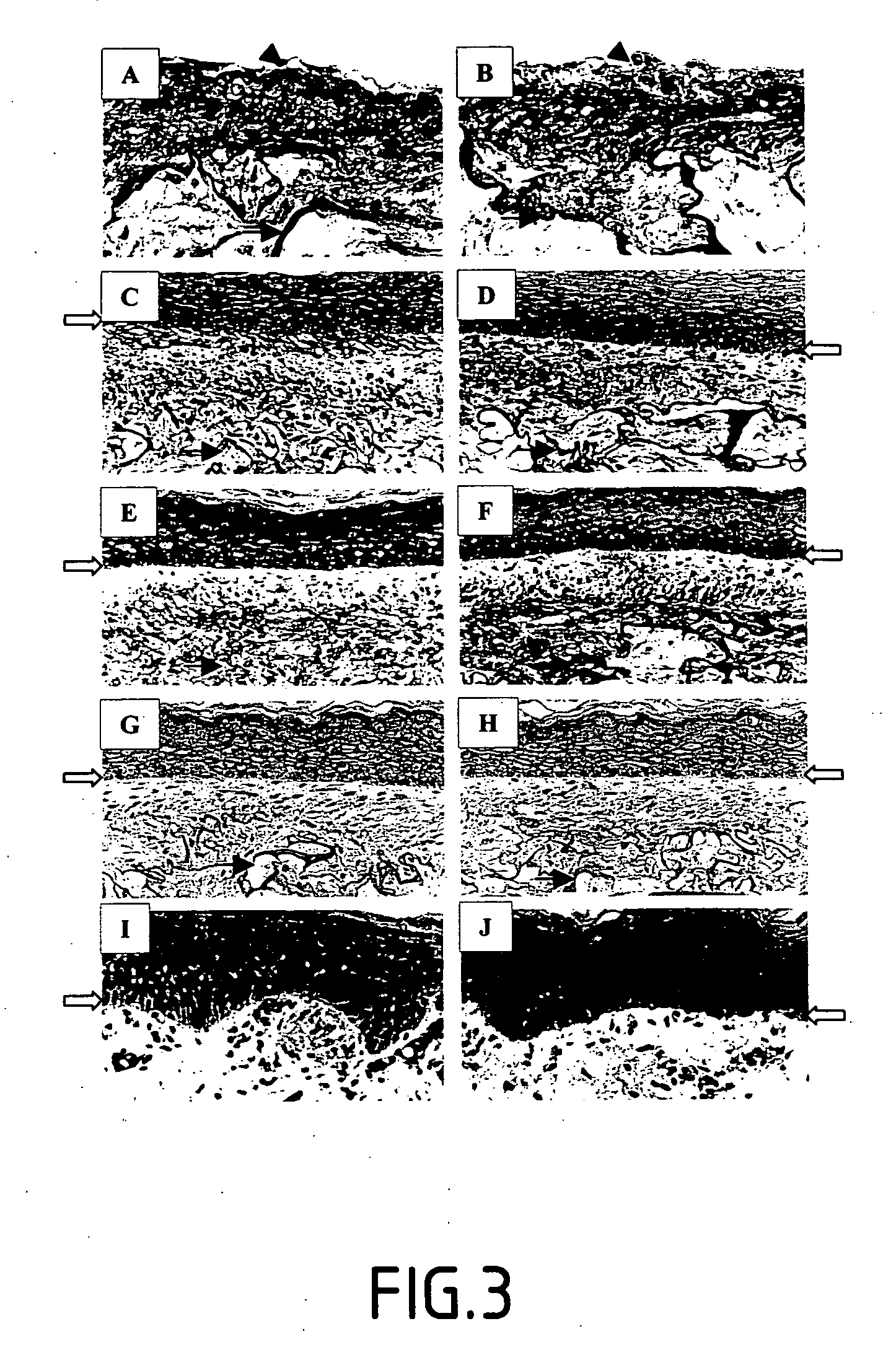 Stimulation of the synthesis of the activity of an isoform of lysyl oxidase-like LOXL for stimulating the formation of elastic fibres