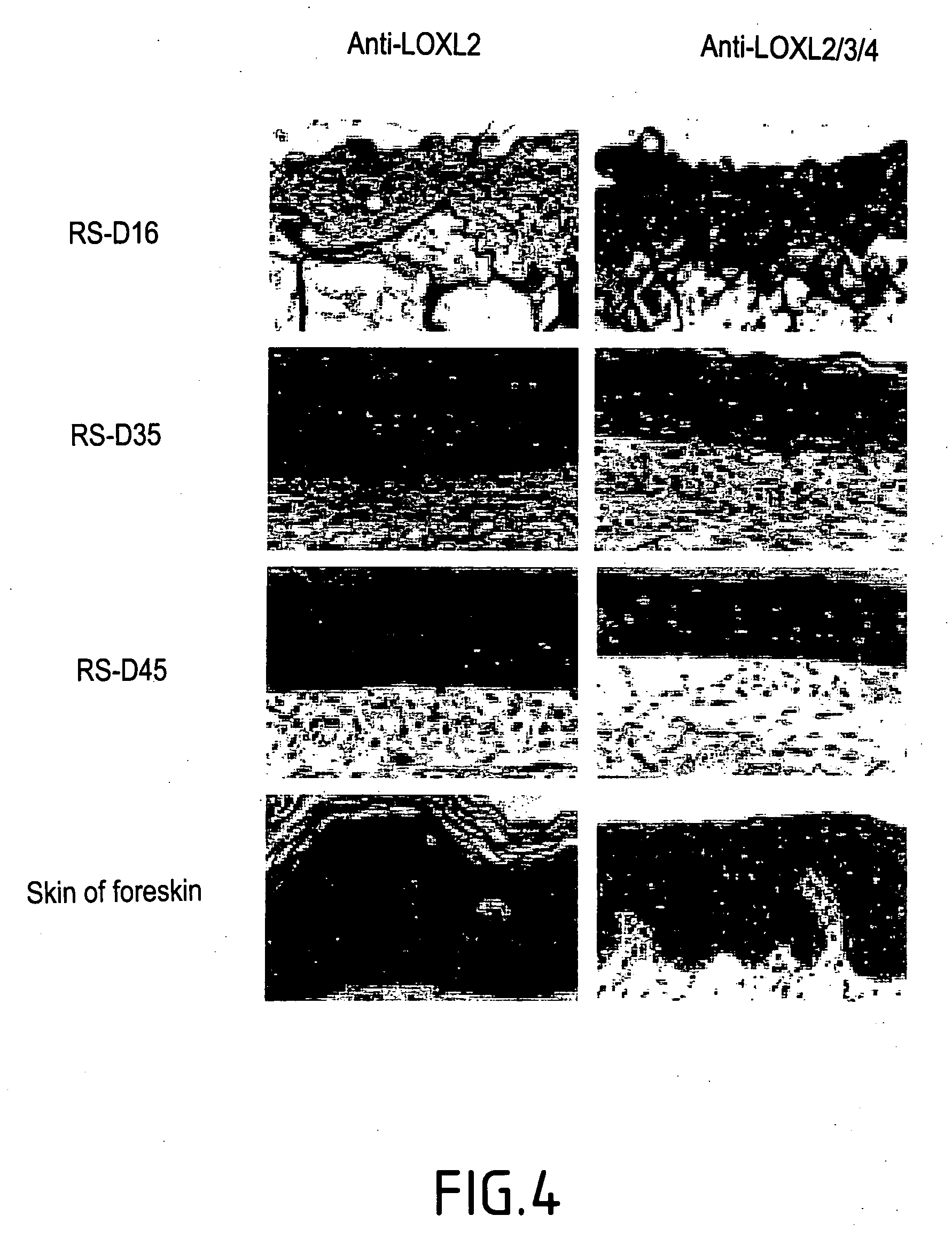 Stimulation of the synthesis of the activity of an isoform of lysyl oxidase-like LOXL for stimulating the formation of elastic fibres