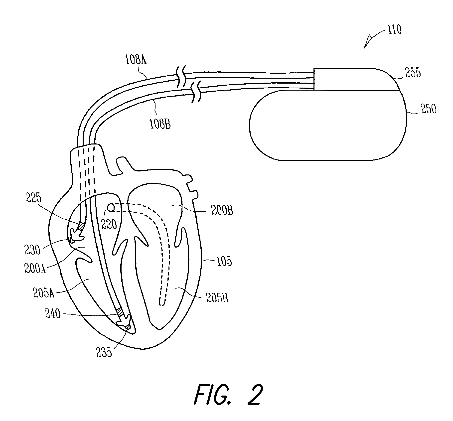 Therapy control based on the rate of change of intracardiac impedance