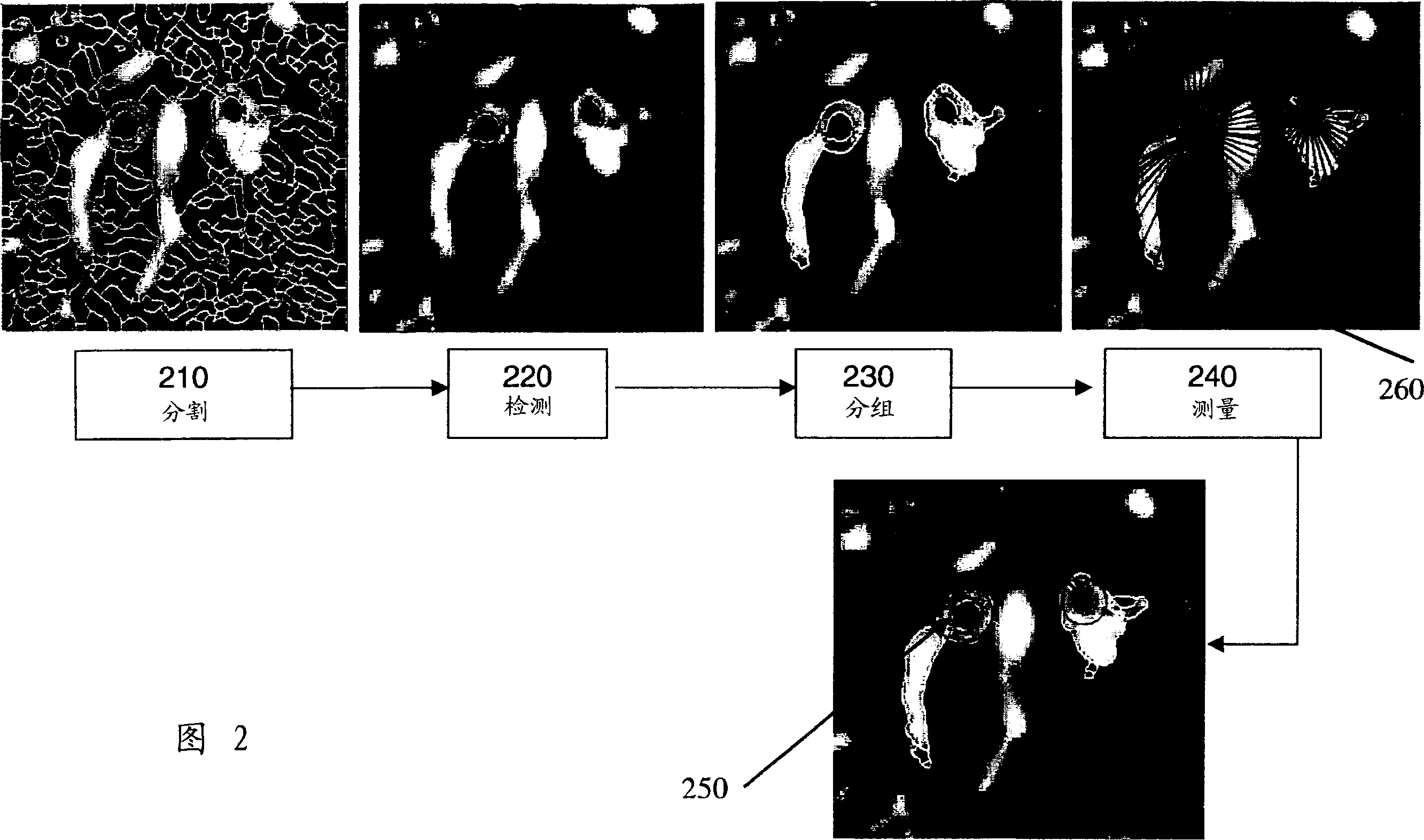 Method and system for airway measurement