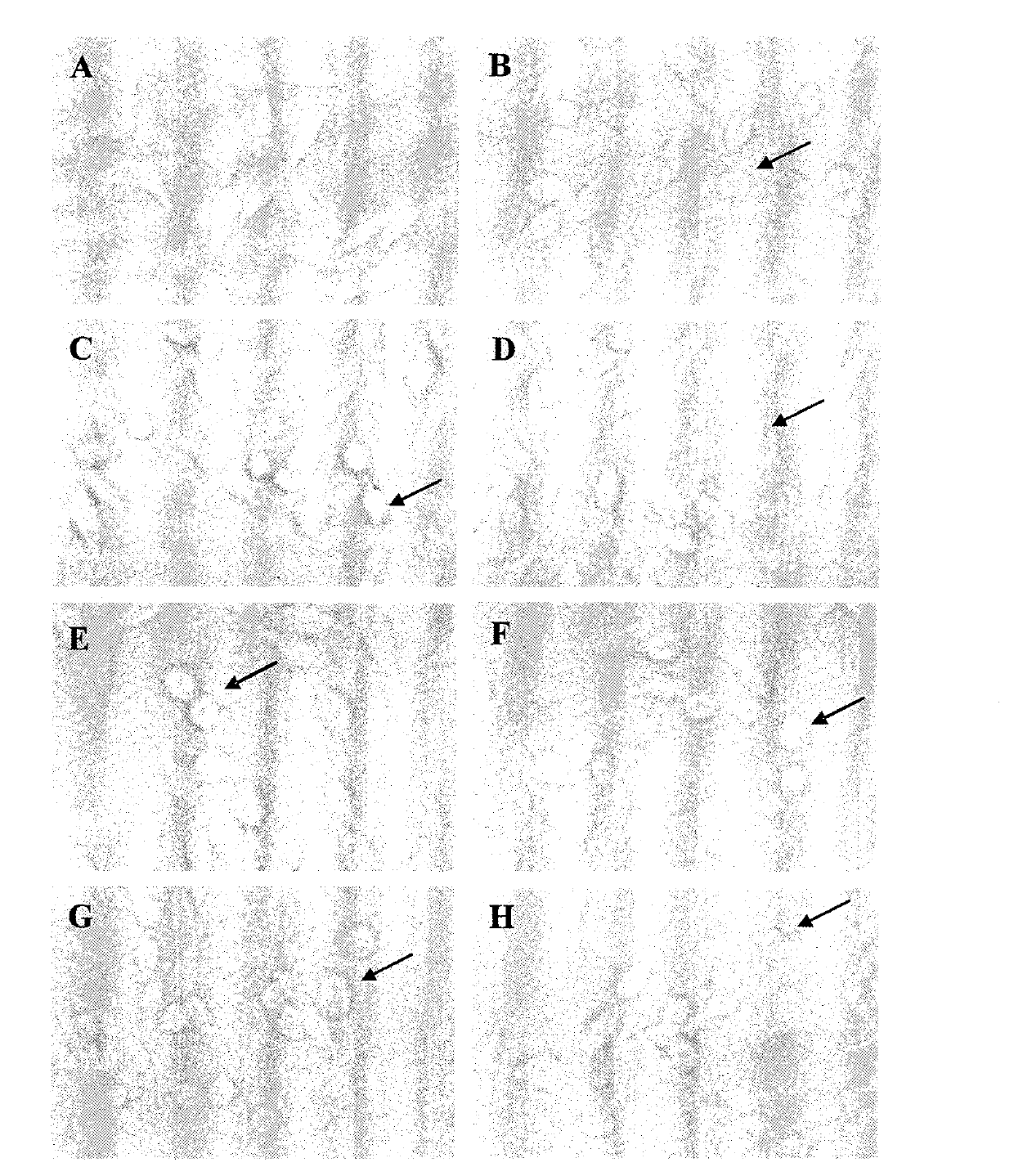 Application of k-carrageenan oligosaccharides capable of adjusting activated states of gitter cell