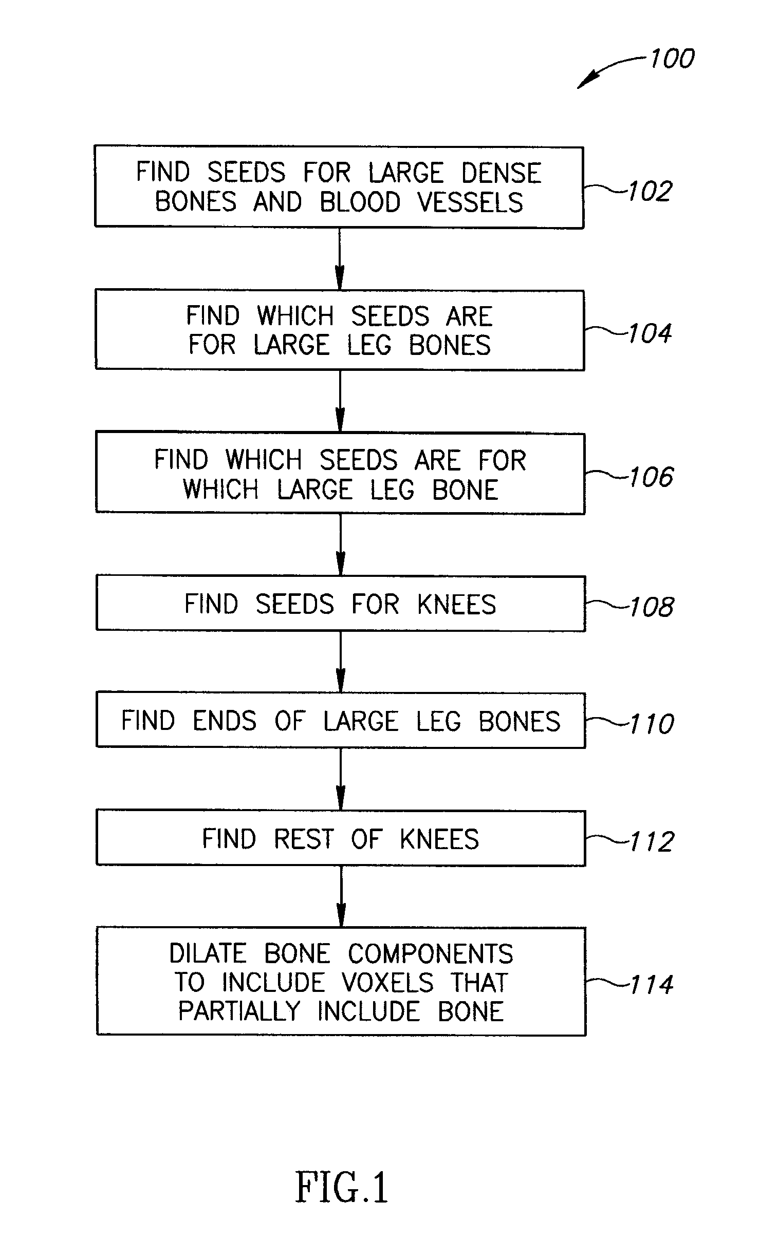 Bone segmentation