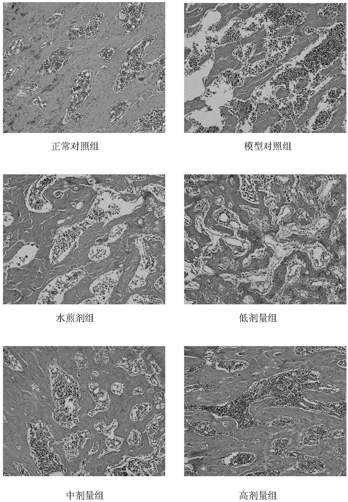 A pharmaceutical composition for preventing and treating osteoporosis and its preparation method