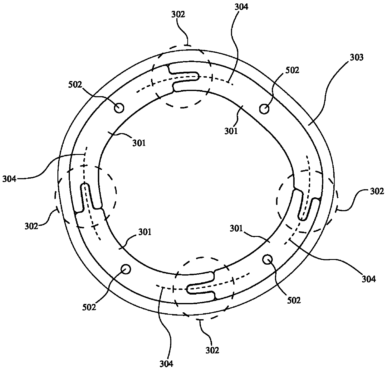 Adaptive three-dimensional orthosis and manufacturing method thereof