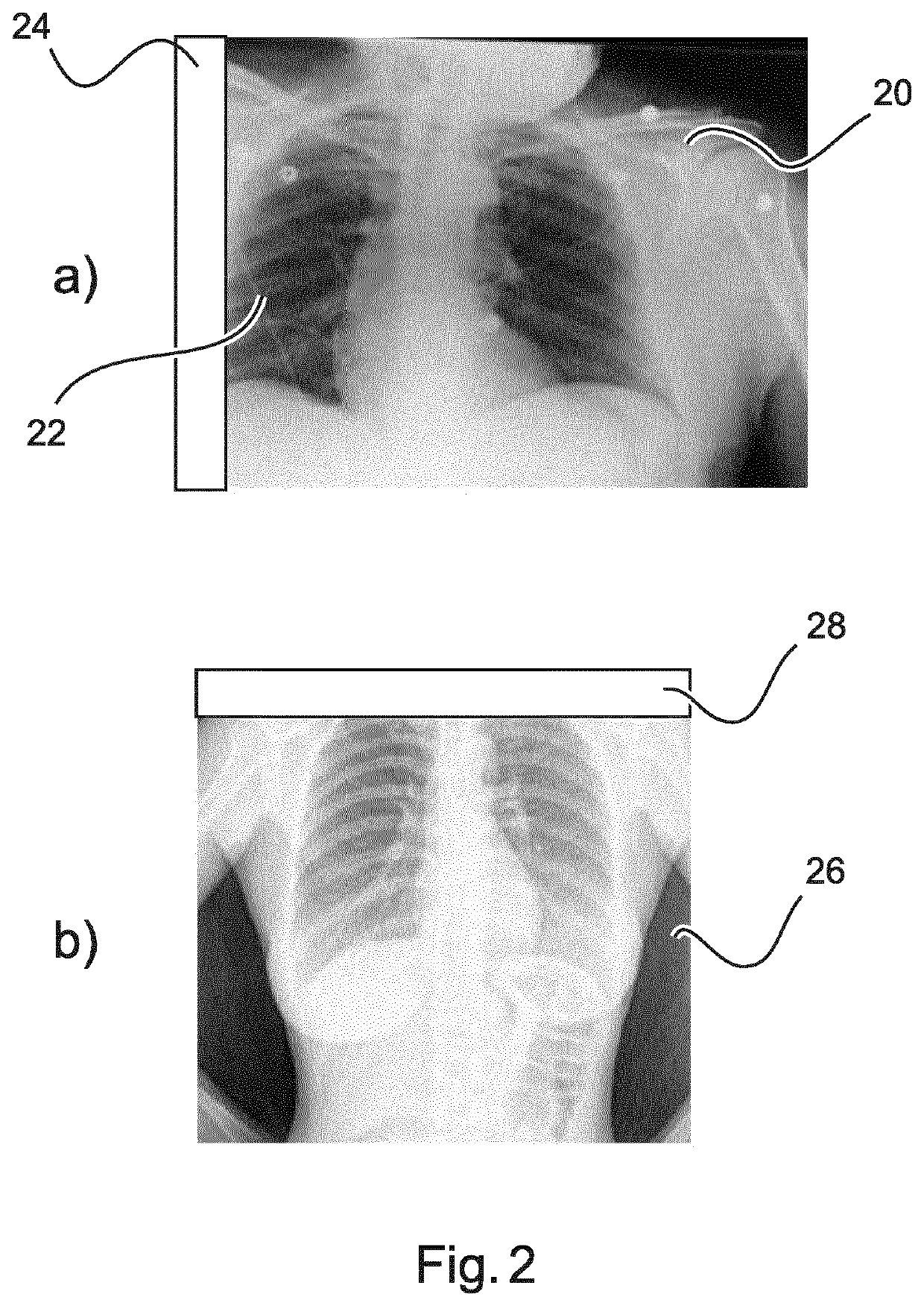 X-ray apparatus having a composite field of view