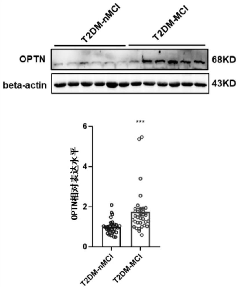 Biomarkers and kits for predicting the risk of MCI in patients with type 2 diabetes and their application