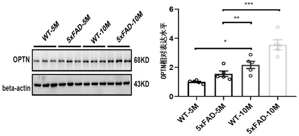 Biomarkers and kits for predicting the risk of MCI in patients with type 2 diabetes and their application