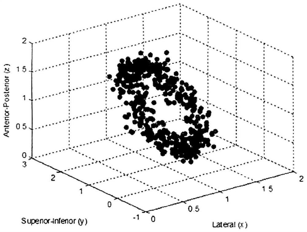 A method for synchronous and real-time calculation of radiation beam angle in radiation therapy