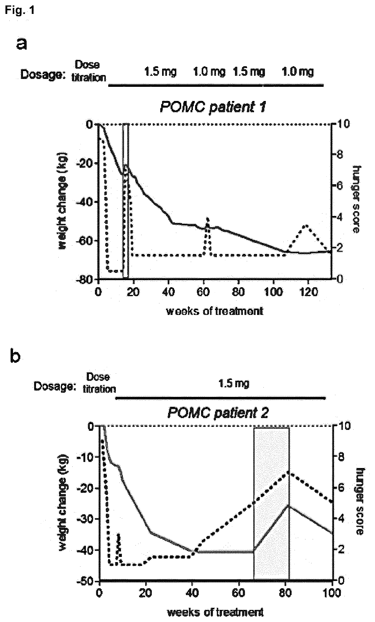 MC4R Agonist Efficacy in Subjects with MC4R Deficiencies and Impaired NFAT Signaling