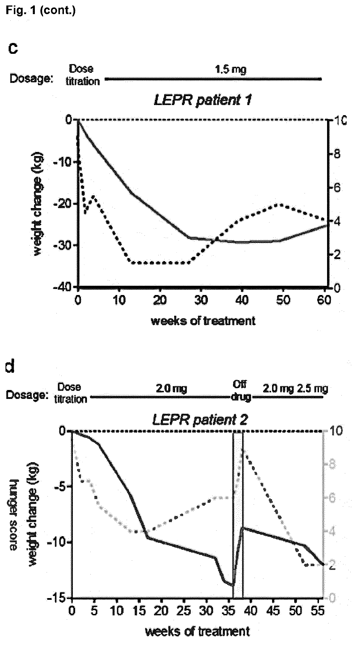 MC4R Agonist Efficacy in Subjects with MC4R Deficiencies and Impaired NFAT Signaling